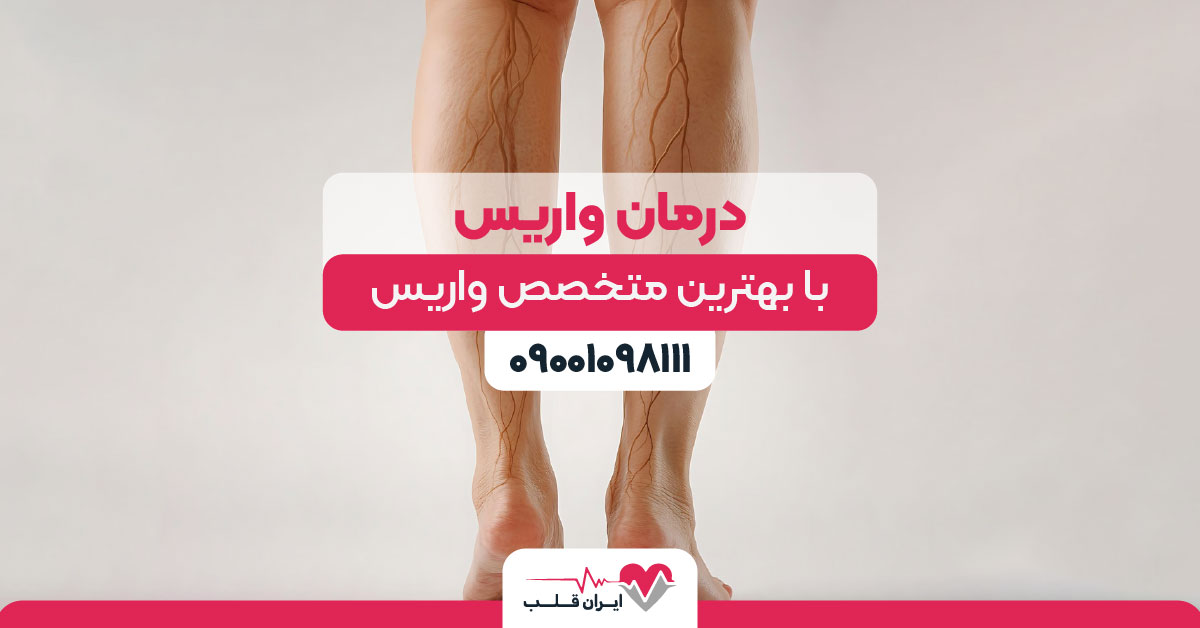 درمان واریس با بهترین متخصص واریس