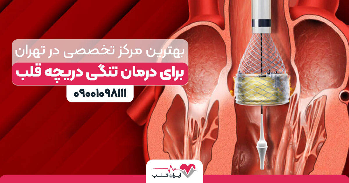 بهترین مرکز تخصصی در تهران برای درمان تنگی دریچه آیئورت